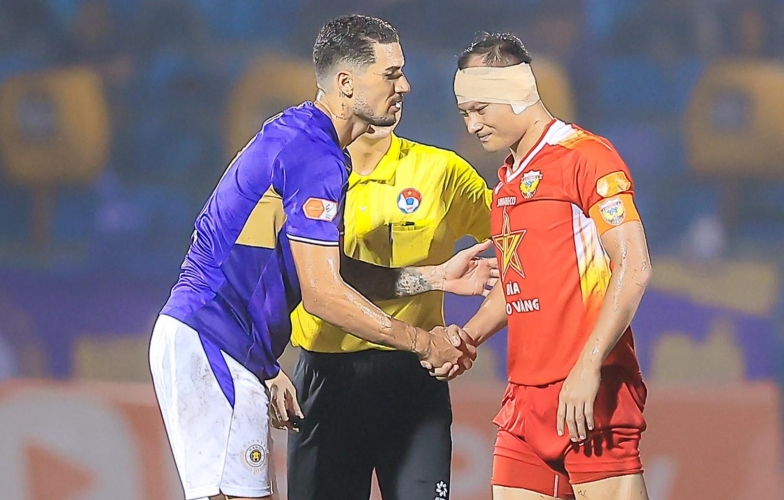 Strong collision with Hoàng Hên, veteran Trọng Hoàng nearly tore his ear