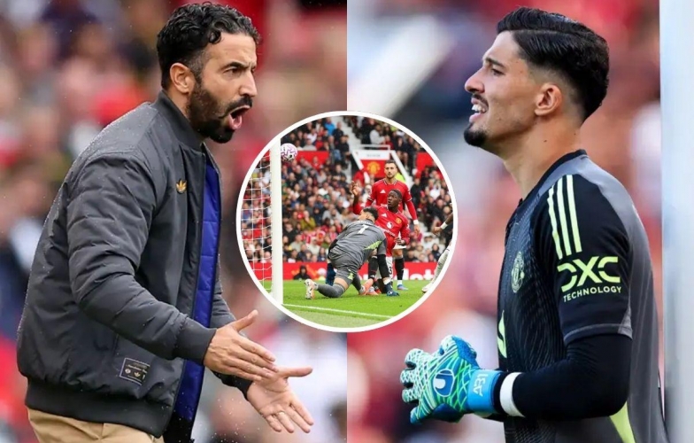 Ruben Amorim: &#39;Being a Manchester United goalkeeper right now is really tough!&#39;