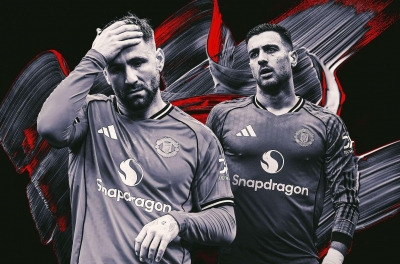 Manchester United must upgrade their position if they want to compete for the championship