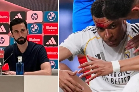 Coach Arbeloa furious: 'Mbappe incident, even on the moon would be a penalty'