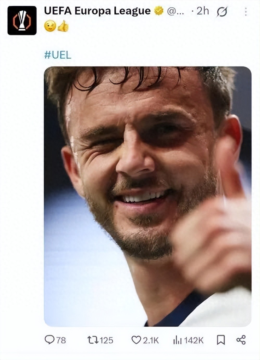 The Europa League social media has been bombarded with negative reviews for posting a photo of the smiling face of Maddison, who had just been seriously injured in the game