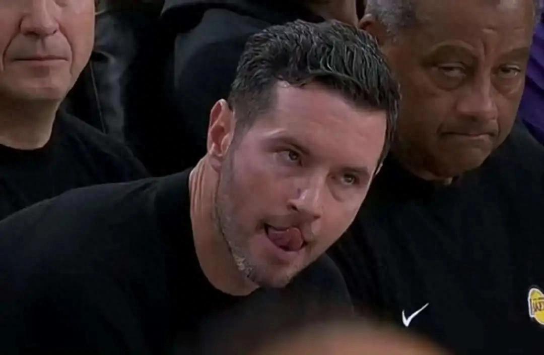 Doncic injured again! Lakers extend a helping hand to the Clippers