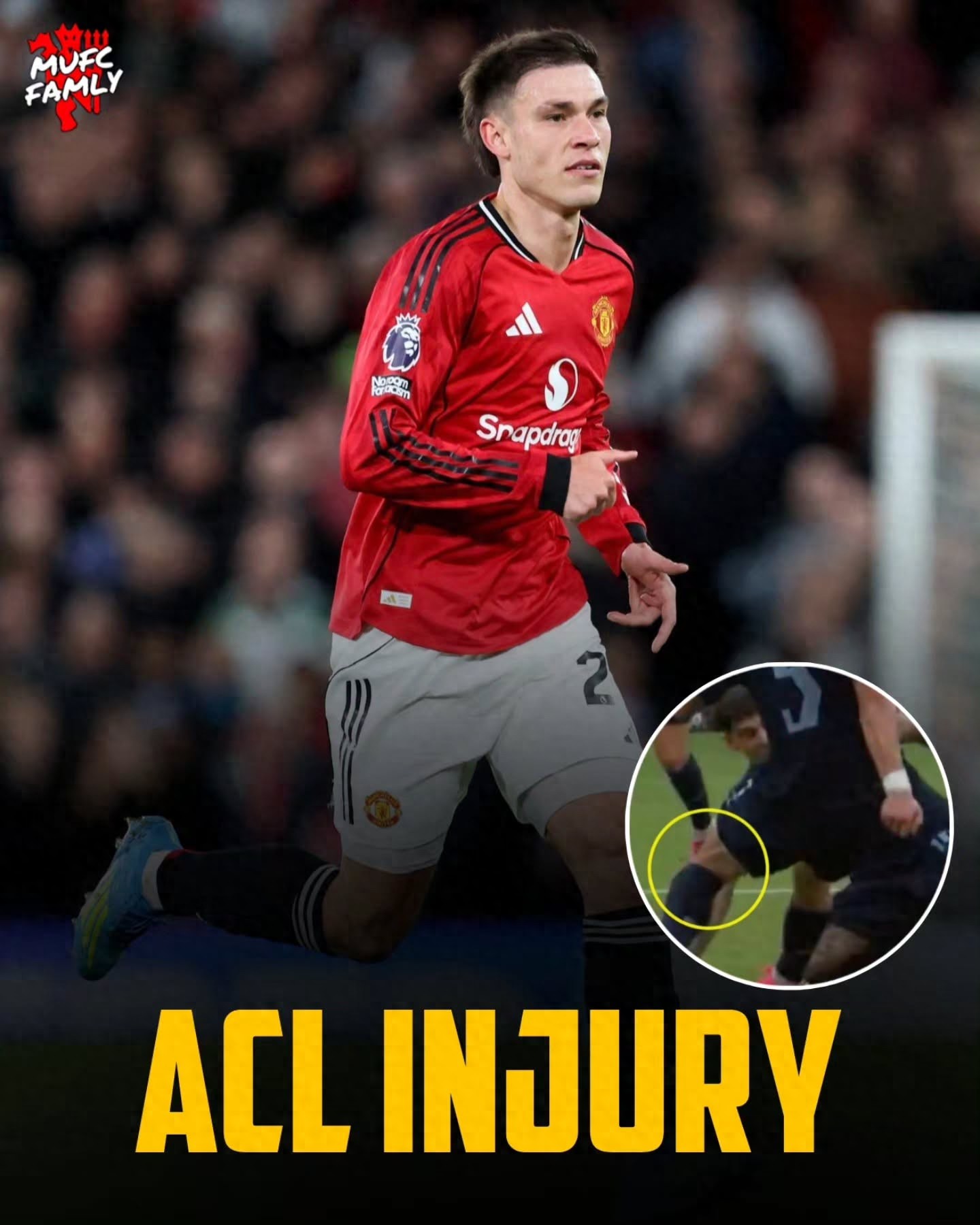 Manchester United officially announced Ugarte's injury, and he revealed it is the most serious knee problem he has ever had! Ratcliffe wants to sell Mount to raise funds for a new signing